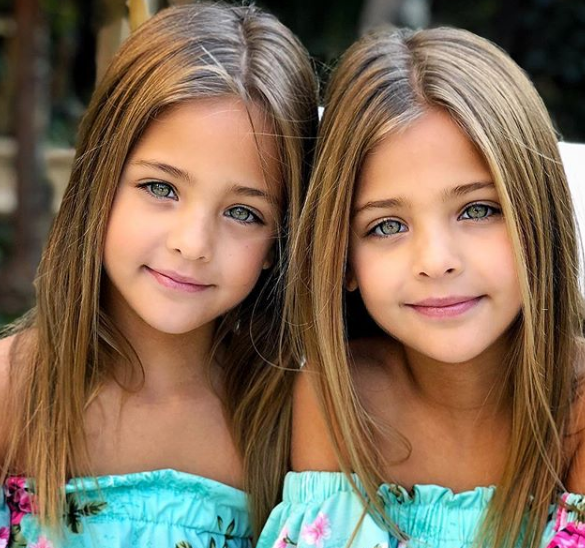 Найдены самые красивые в мире близняшки: обворожительные фото