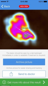 Разработано приложение, определяющее рак по фото