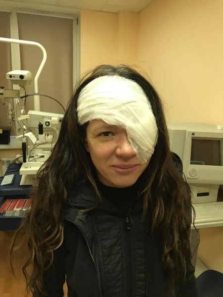 Руслана перенесла серьезную операцию на глазу и вышла на сцену с открытой раной