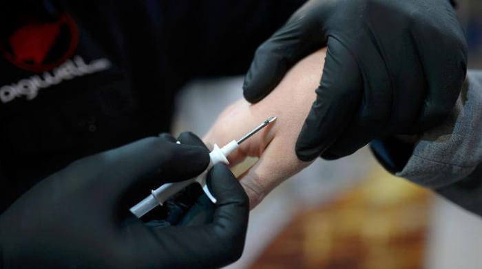 Подкожный проездной: в Швеции люди массово вживляют чипы с личными данными под кожу