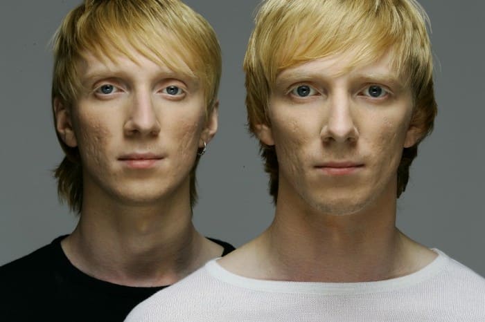 Как две капли: Самые известные близнецы российского шоу-бизнеса
