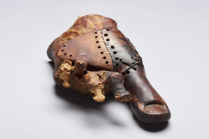 10 древних (и не очень) протезов, которые вошли в историю человечества