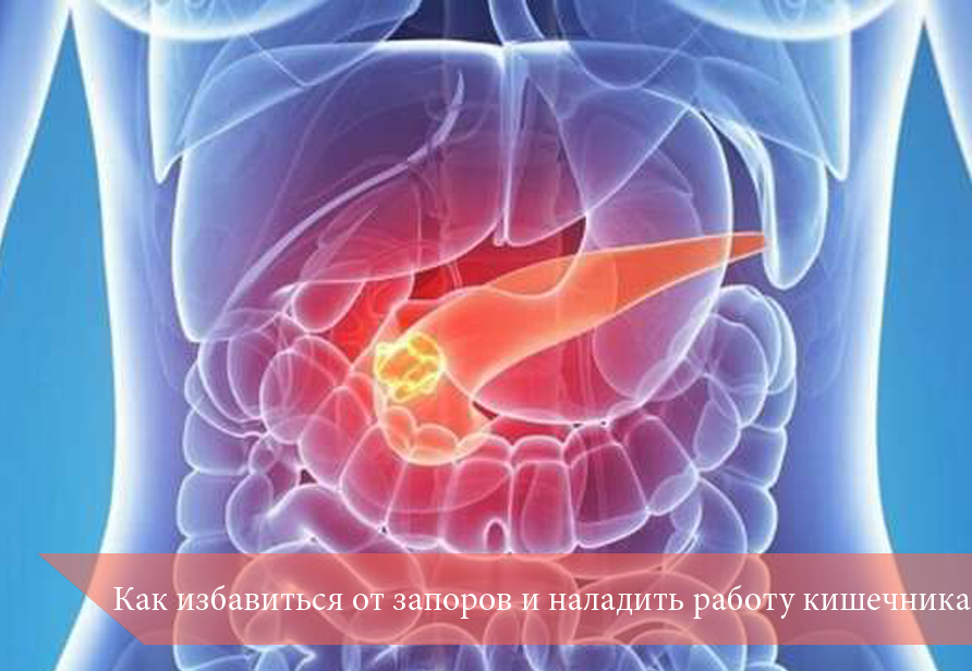 Как избавиться от запоров и наладить работу кишечника