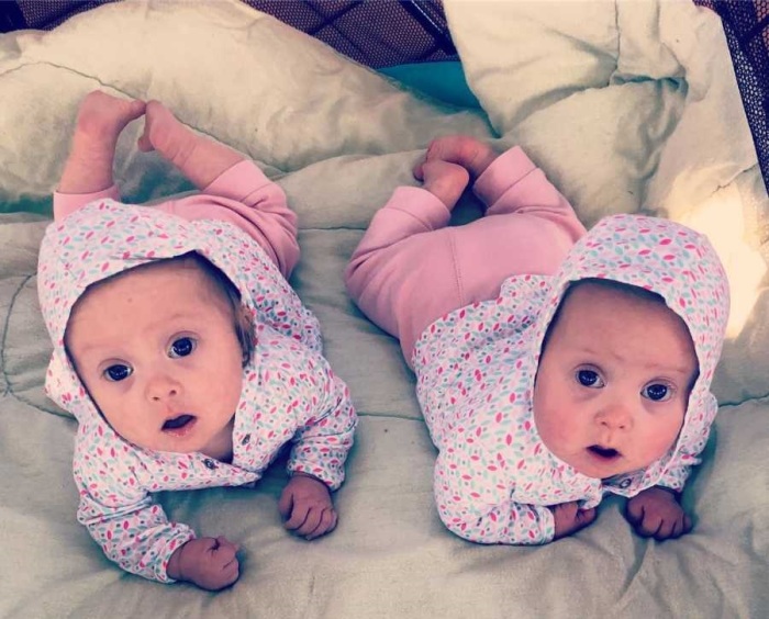 Мамина радость Анетта и Шарлотта: как близняшки с синдромом Дауна очаровали весь мир