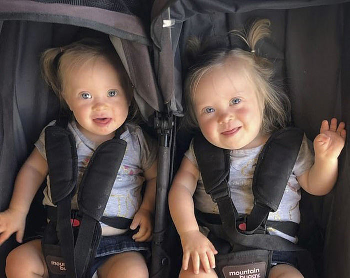 Мамина радость Анетта и Шарлотта: как близняшки с синдромом Дауна очаровали весь мир