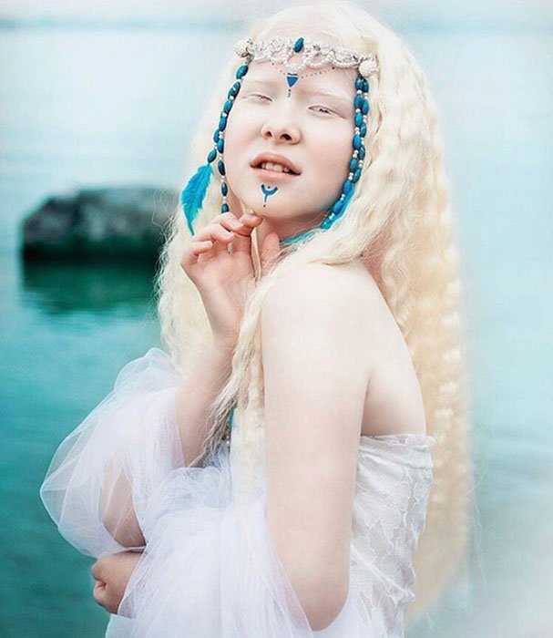 Ангелоподобные красотки: Как живётся сёстрам-альбиносам из Казахстана