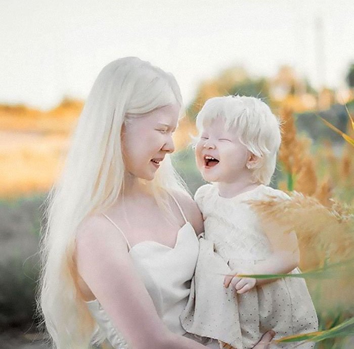 Ангелоподобные красотки: Как живётся сёстрам-альбиносам из Казахстана