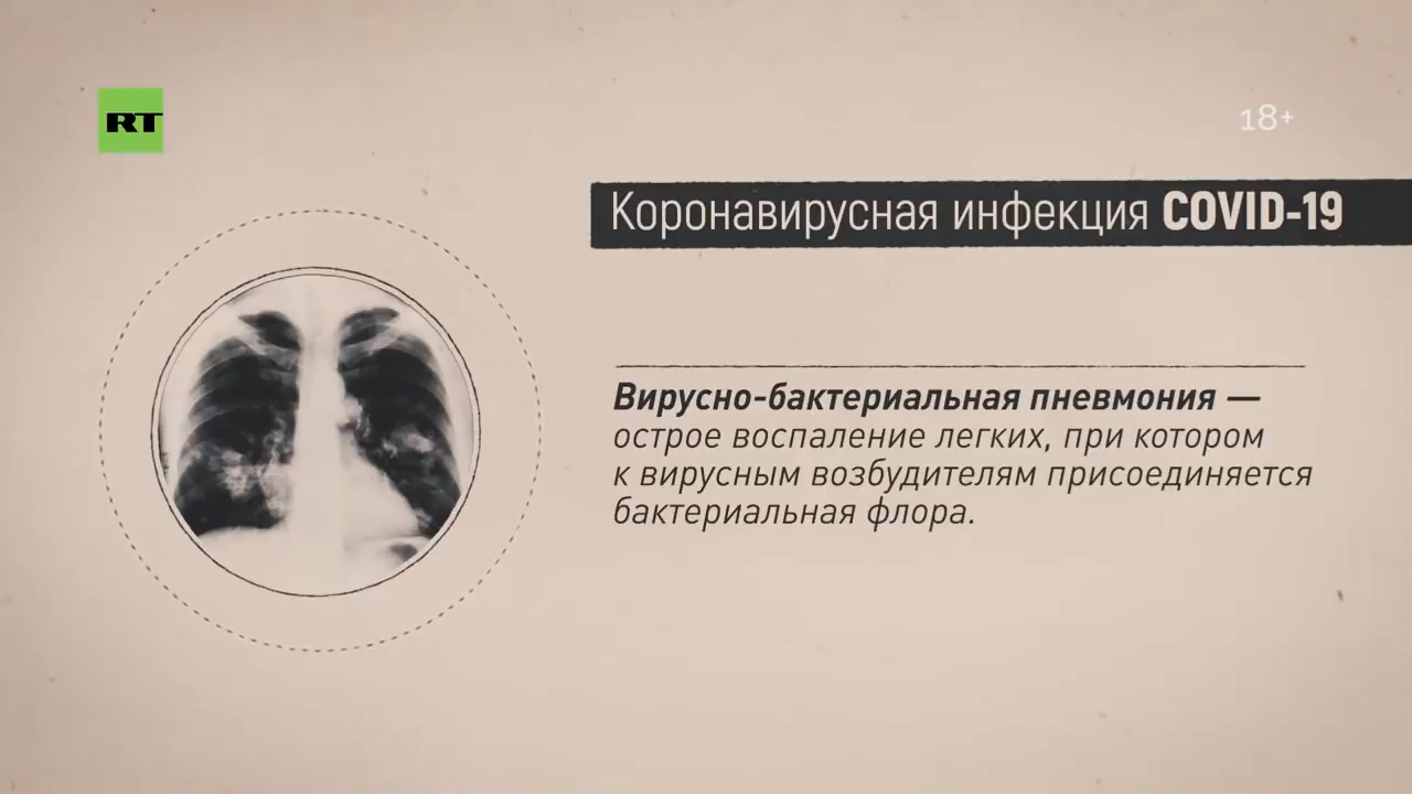 «В этой ситуации есть сильные стороны российского здравоохранения»: пульмонолог о рисках эпидемии коронавируса в РФ