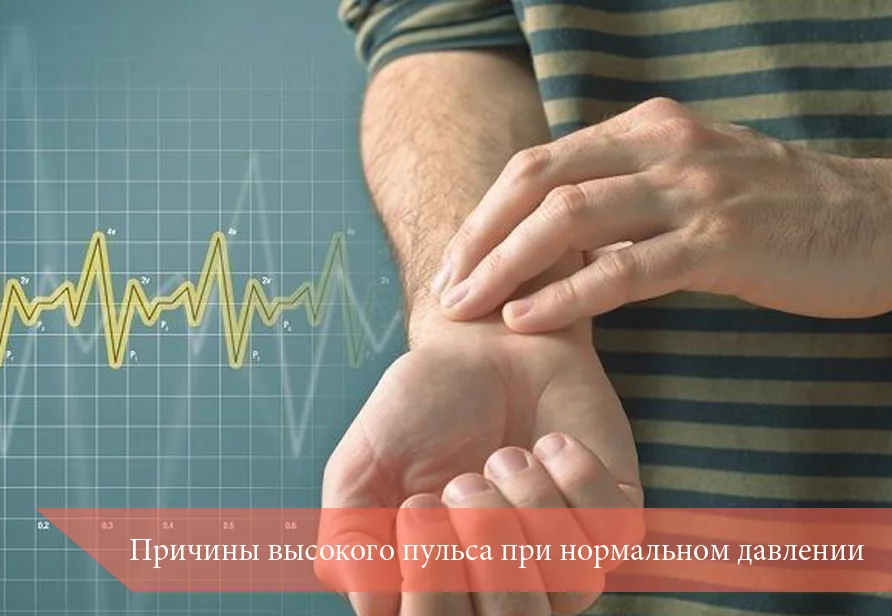 Причины высокого пульса при нормальном давлении