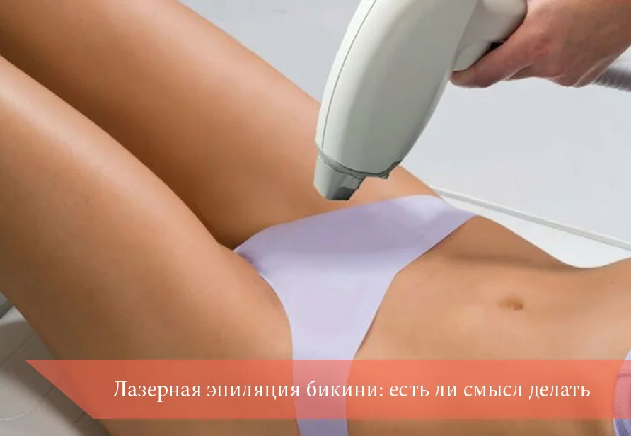 Лазерная эпиляция бикини: есть ли смысл делать