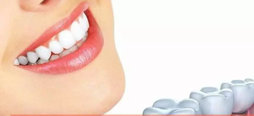 Чего нельзя делать, если во рту стоят импланты?